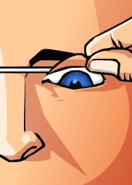 QUEMADURA OCULAR