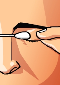 QUEMADURA OCULAR