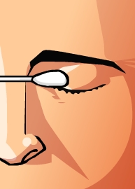 QUEMADURA OCULAR
