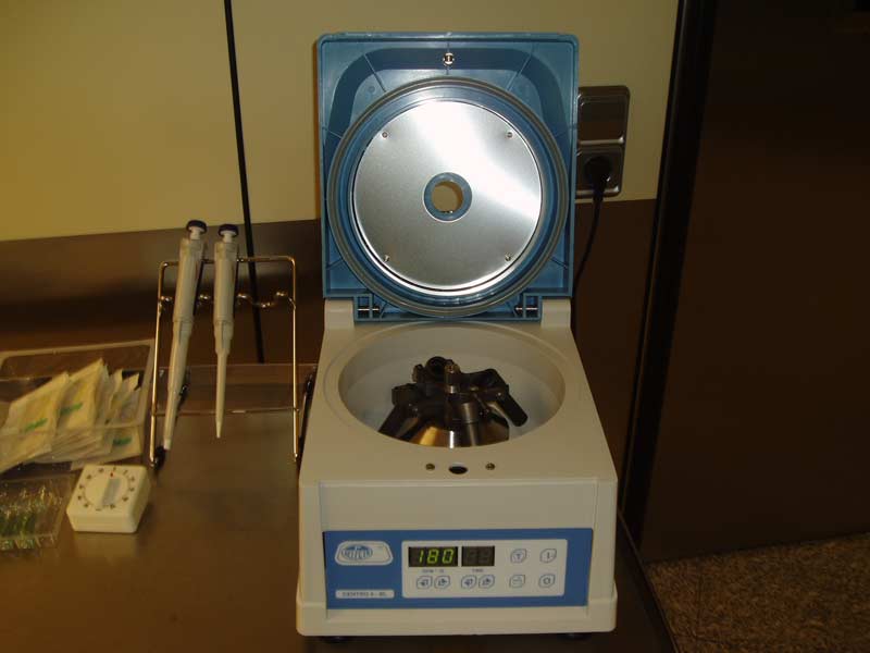 PLASMA RICO EN PLAQUETAS (P.R.P.)