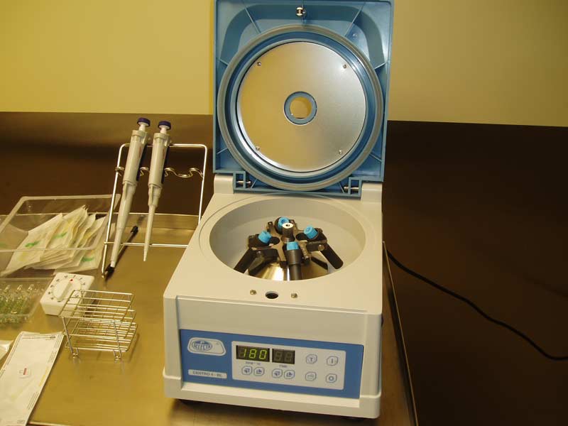 PLASMA RICO EN PLAQUETAS (P.R.P.)