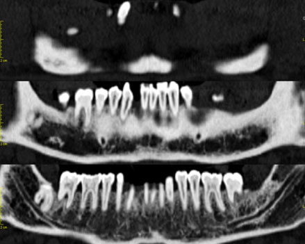 TAC DENTAL